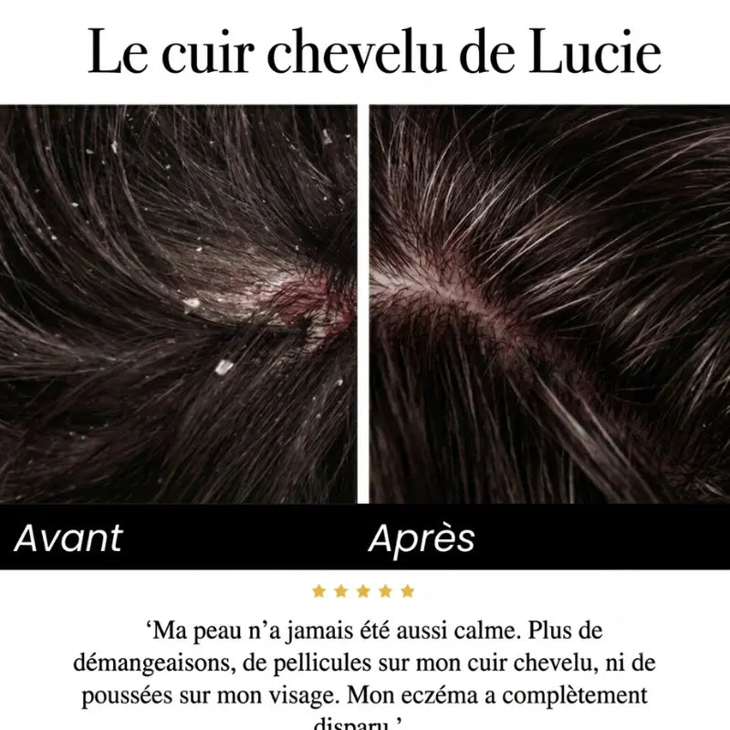Sérum Apaisant Naturel