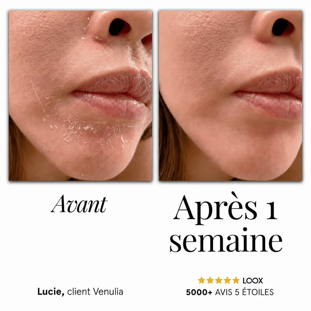 Sérum Apaisant Venulia